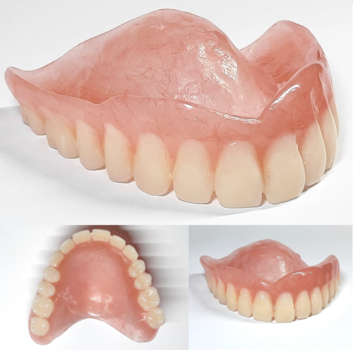 Dental Denture (Prostheses)